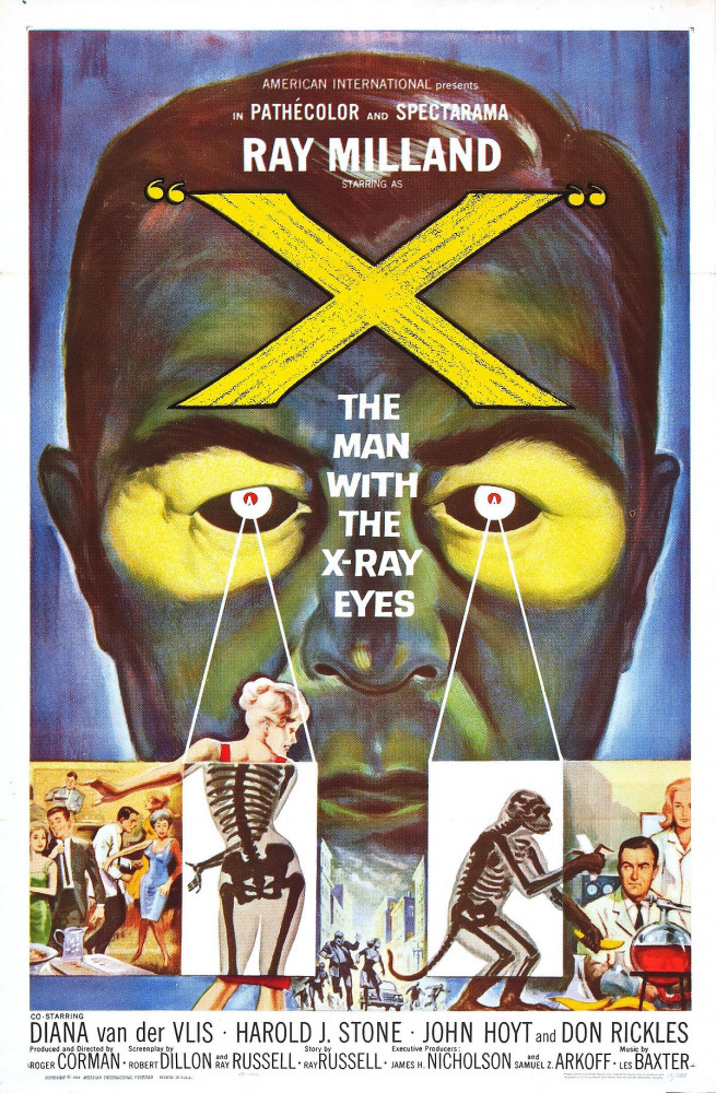 El hombre con rayos X en los ojos